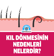 Kil Donmesinin Nedenleri Nelerdir Saglik Doktorlar Bilgi