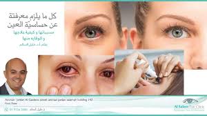 حساسية العين أنواعها و علاجها عيادات السالم لطب و جراحة العين أ د خليل السالم