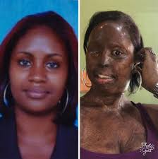 Historias De Superación