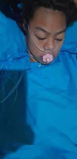 My Daughter's Fight with Microcephaly