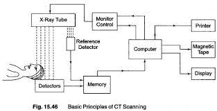 Ct Scan Basic Principle