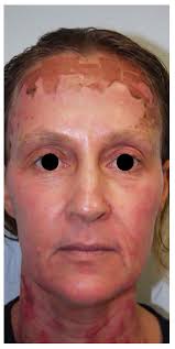 We are waiting for you. Co2 Laser Resurfacing Cosmetique Aesthetics Co2 Laser Resurfacing Cosmetique Aesthetics
