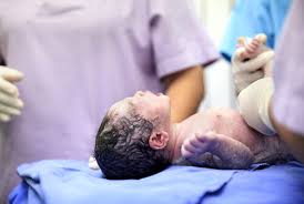 Image result for Breech Presentation