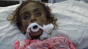 Image result for Yemen children being killed