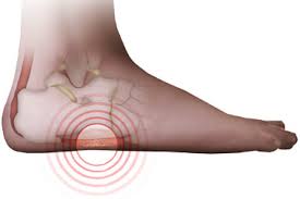 I've tried moving the cleat all the way back, moving the cleat to outside my thoughts are that the edge of my foot is rolling over the outsole when i pedal, causing pressure along the outside edge. Do You Have Pain On The Outside Of Your Foot Achilles Podiatry