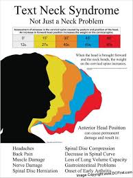 Text Neck Syndrome Poster 18 X 24 Anterior Head Carriage Chiropractic Physical Therapy Text Neck Neck Problems Massage Therapy