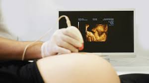 Sebarang bentuk pengiklanan, promosi diri, video dan apa jua bentuk yang tidak 2. Kenapa Detail Scan Baby Lebih Penting Daripada Scan 3d 4d 5d June 2021 Kelabmama Malaysia