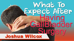 In This Video I Explain What You Will Expect After Having Gallbladder Removal Surgery This Video Is Gallbladder Surgery After Gallbladder Surgery Gallbladder