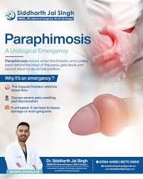 Image result for paraphimosis