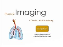Hemi diaphragm normal chest anatomy lateral chest xray colon gas trachea oblique fissure horizontal fissure rt. Ct Anatomy Of The Chest Dre 2 Dr Mamdouh Mahfouz Youtube