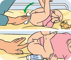 It's really not good to put a nappy on the donkey, the donkey can kick very strong once if you touch him/her at the back. Changing Nappies Step By Step Guide Raising Children Network