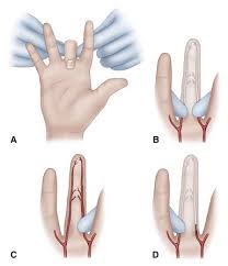 Image result for Allen Test