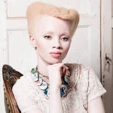 Beauty Black Beauty Black Albino Beauty From Thank God I M Natural On Facebook Natural Hair Styles Black Beauties Black Is Beautiful