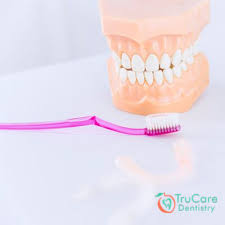 Generally dentures will become loose overtime as the adhesive or strips wear off. How To Clean Your Dentures And Prevent Bacteria From Building Up Trucare Dentistry Roswell