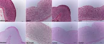 Image result