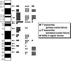 Ovarian Dysgenesis And Premature Ovarian Failure Caused By X