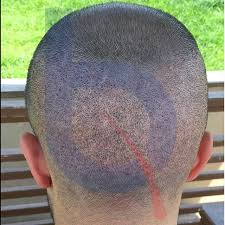 New The 10 Best Hairstyle Ideas Today With Pictures Biomed Hair Sac Ekim Merkezi Sacsakal Ve Kas Ekimi Prp Google Home Mini Smart Assistant Google Home