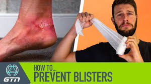 Popping will break the skin and invite bacteria to enter the body, heightening the risk of infection. How To Prevent Blisters When Running Stop Your Run Shoes Rubbing Youtube
