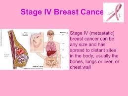 How does lung cancer spread to brain? Breast Cancer Awareness Sheraton Kuwait Crystal Ballroom Ppt Video Online Download