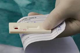 Maybe you would like to learn more about one of these? Testes Rapidos Do Coronavirus Em Farmacia Tire Duvidas Sobre A Venda Qual Uso Indicado E O Que Se Sabe Sobre A Eficacia Coronavirus G1