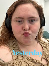 Hi everyone, does anyone get really bad mid back pains during a flare?