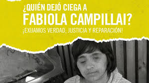 Fabiola campillai rojas (36) está recostada sobre un sillón en una sala individual del instituto de salud del trabajador en el barrio franklin, en santiago centro. Amnistia Chile Twitterissa Quien Dejo Ciega A Fabiola Campillai A 9 Meses De Su Ataque Por Carabineros Aun No Hay Formalizacion De Los Responsables De Los Hechos Exijamos Verdad Justicia Y Reparacion