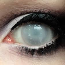 Sfx Kingdom Cloudy Zombie Effect Apocalypse Aesthetic Eye Photography White Eyes