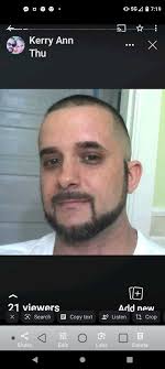 What is the healing process after plexiform removal from the thigh?