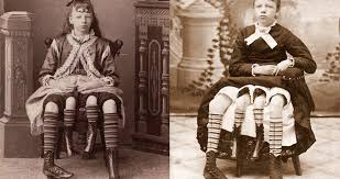 Bicknell died only one week before her sixtieth birthday; The Story Of Myrtle Corbin P T Barnum S Four Legged Girl From Texas