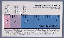 The word intersex has come into preferred usage for humans, since the word hermaphrodite is considered to be misleading and stigmatizing intersex conditions happen when babies are born with a mixture of male and female genitalia. Intersex Society Of North America Wikipedia
