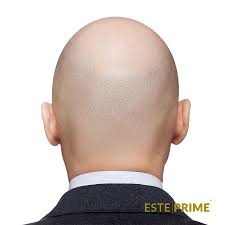 Esteprime Hair Transplantation Adli Kullanicinin Sac Ekimi Yontemleri Panosundaki Pin Sac
