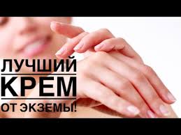 как избавиться от экземы на руках в домашних условиях Luchshij Krem Ot Ekzemy Youtube