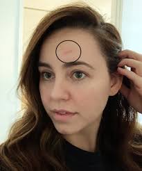 How to use a blackhead vacuum. I Tried A Blackhead Vacuum Here S What Happened The Everygirl