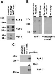 We're the leading nonprofit committed to strengthening our st. Regulation Of Aquaporin 2 Trafficking By Vasopressin In The Renal Collecting Duct Journal Of Biological Chemistry