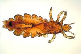 How To Clean Your House After A Case Of Head Lice Ehow Head Louse Lice Infestation Louse
