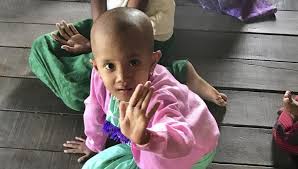 Bone marrow aspiration and biopsy: Inside Yangon Children S Hospital World Child Cancer