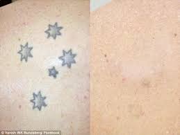The cross tattoo has been a popular fixture in the ink world since tattoos were invented. Southern Cross Tattoos Covered Up Due To Racist Stigma Daily Mail Online