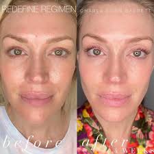 Amanda Soder R+F SkincareConsultant