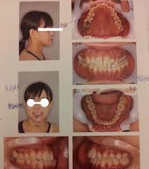 顎 変形 症 大阪