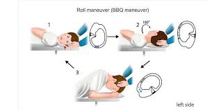 Image result for Canalith Repositioning Procedure
