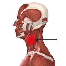 Dolore sternocleidomastoideo: le principali cause e i rimedi