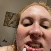 TOP 10 BEST Botox in Johns Creek, GA