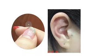 Acupuncture Needle Magnetic Beads Auricular Ear Stickers Vaccaria Seeds Massage Paste Ear Stickers Auricular Ear Auriculotherapy Therapy Massagers Massage Therapy For Cellulitemassage Therapy Spas Aliexpress