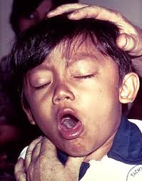 The material may appear to be vomit but could actually be mucus and fluids from the respiratory system. Cough Wikipedia