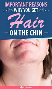 Chin Hair 6 Embarrassing Red Flags No Woman Should Ever Ignore Chin Hair Removal Chin Hair Hair On Chin Women