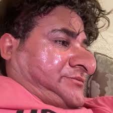 Louis « Mayo » Allen (@paulprovins11)