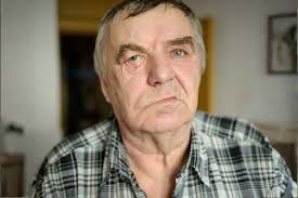 Image result for Progressive Bulbar Paralysis