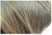 What Does Scalp Build Up Look Like