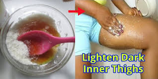 Washing your thighs and groin area with oatmeal water can also help shrink the cyst on inner thigh. Tips Tricks To Treat Dark Inner Thighs