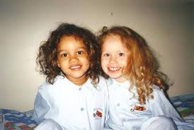 Black And White Identical Twins National Geographic 